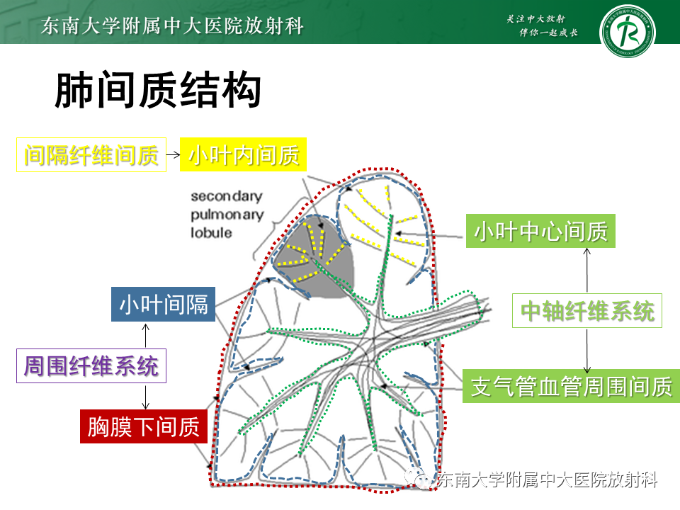 影像PPT - 【PPT】肺间质疾病相关影像鉴别-22