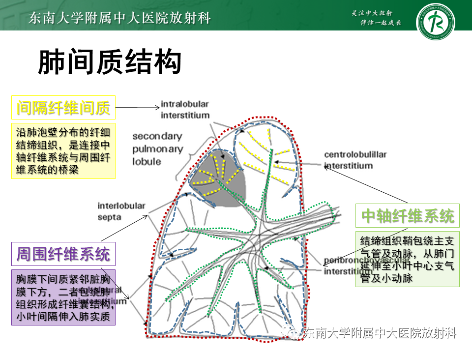 影像PPT - 【PPT】肺间质疾病相关影像鉴别-23