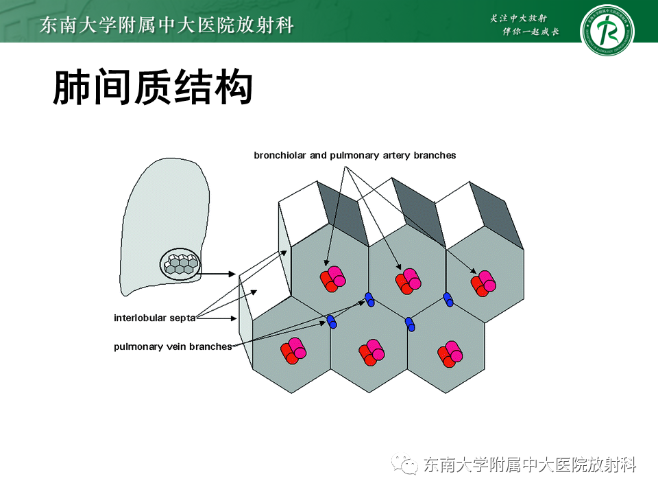 影像PPT - 【PPT】肺间质疾病相关影像鉴别-25