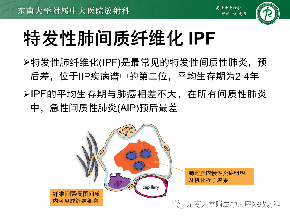 影像PPT - 【PPT】肺间质疾病相关影像鉴别-31