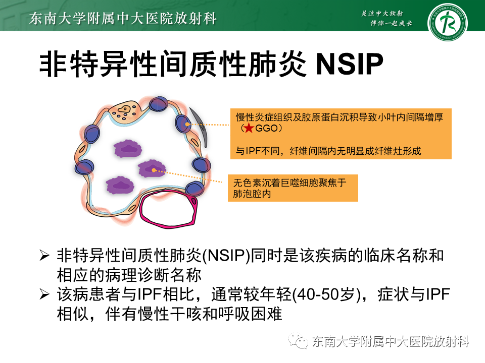 影像PPT - 【PPT】肺间质疾病相关影像鉴别-38