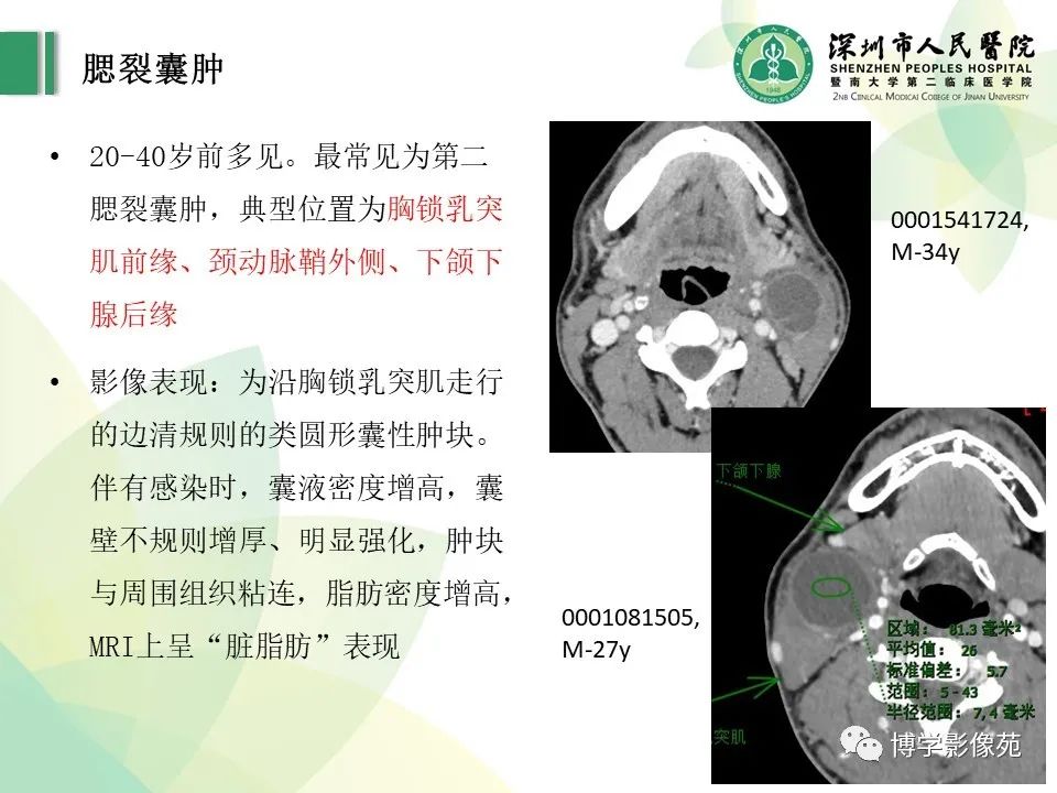 影像PPT - 【PPT】颈部囊性病变-5