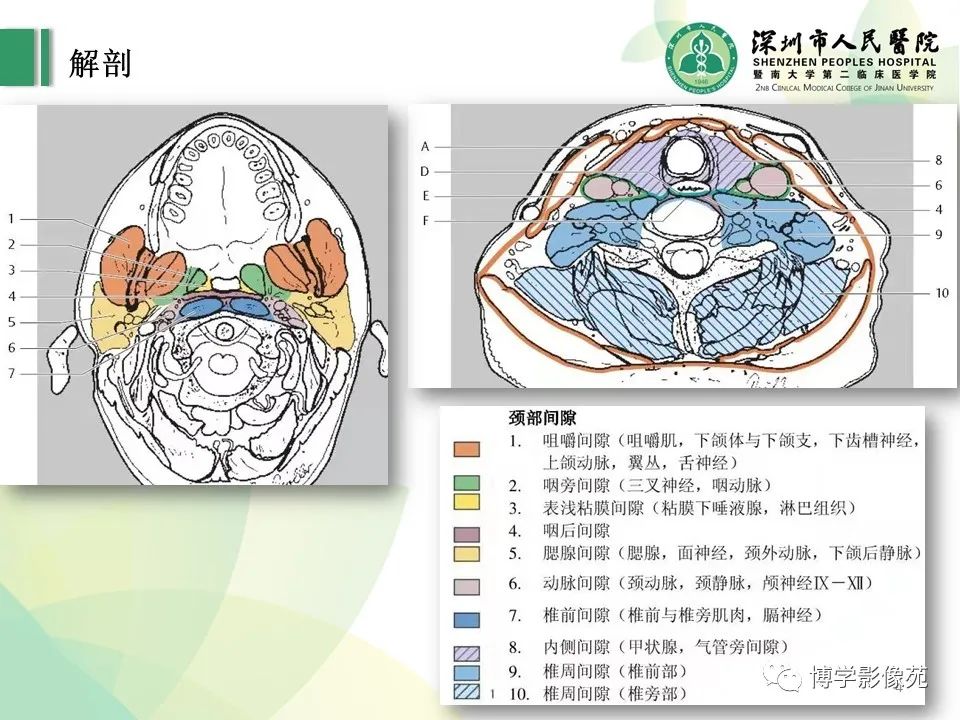 影像PPT - 【PPT】颈部囊性病变-4