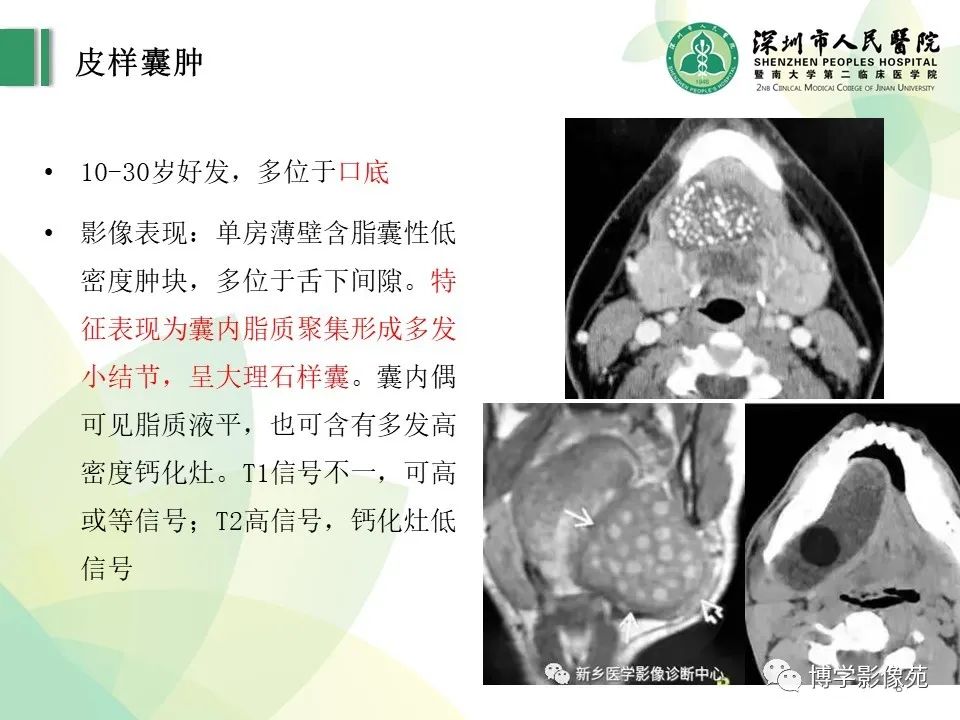 影像PPT - 【PPT】颈部囊性病变-8