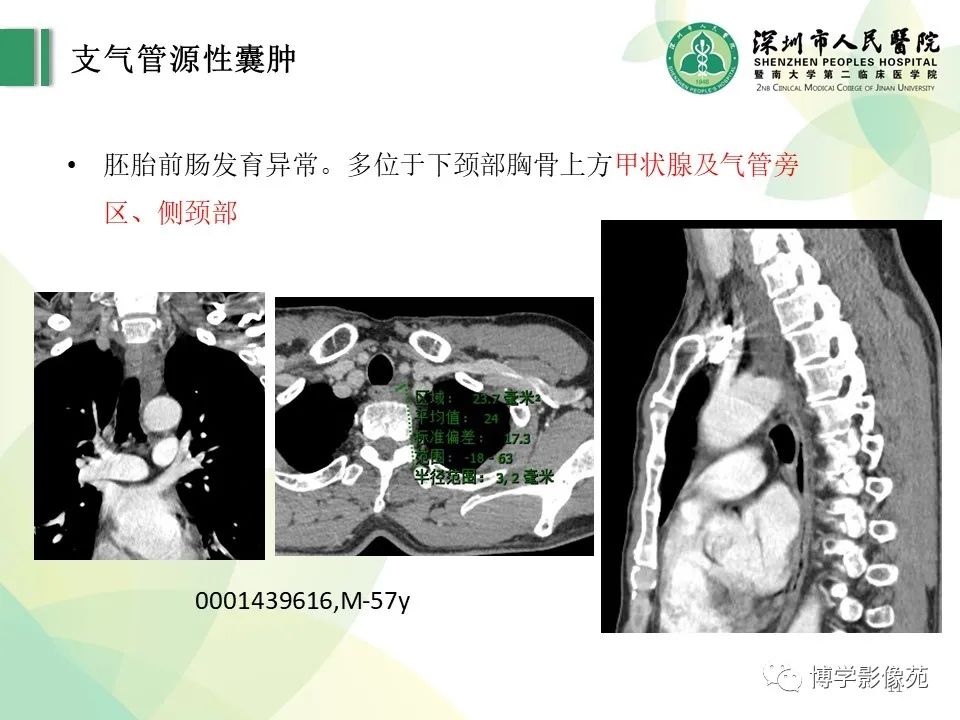 影像PPT - 【PPT】颈部囊性病变-11