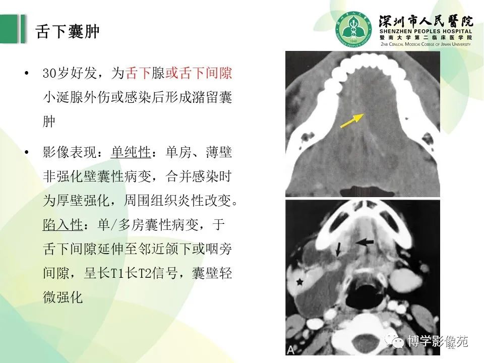 影像PPT - 【PPT】颈部囊性病变-12
