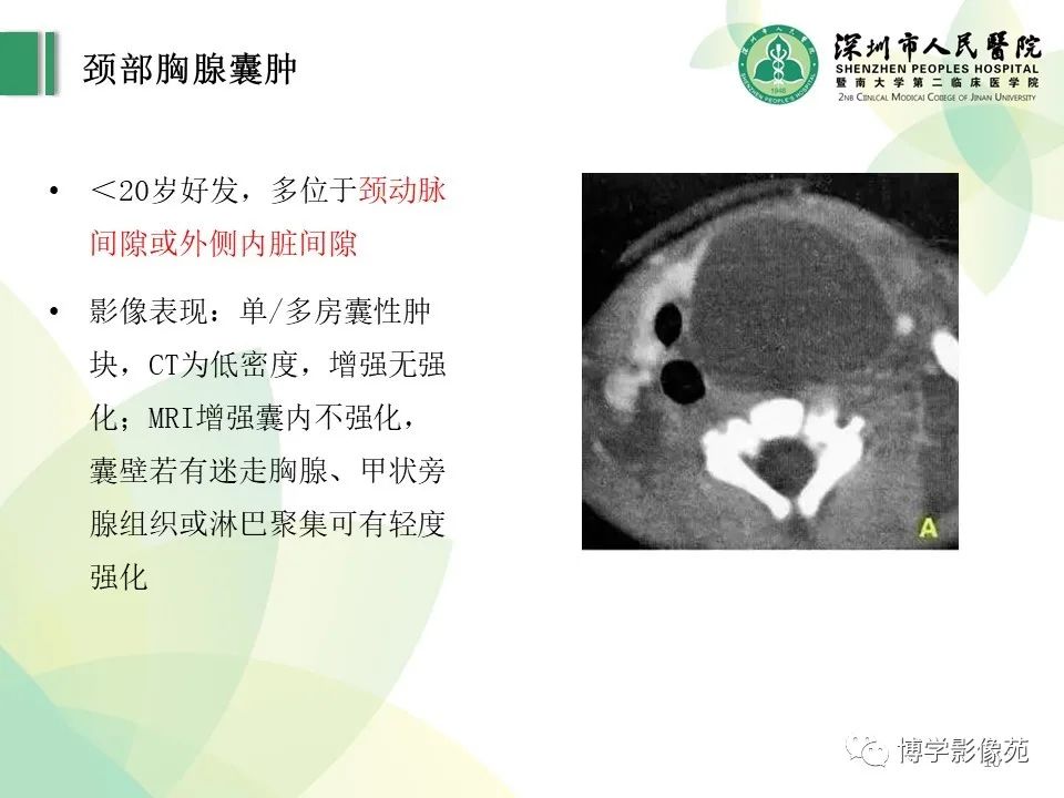 影像PPT - 【PPT】颈部囊性病变-10
