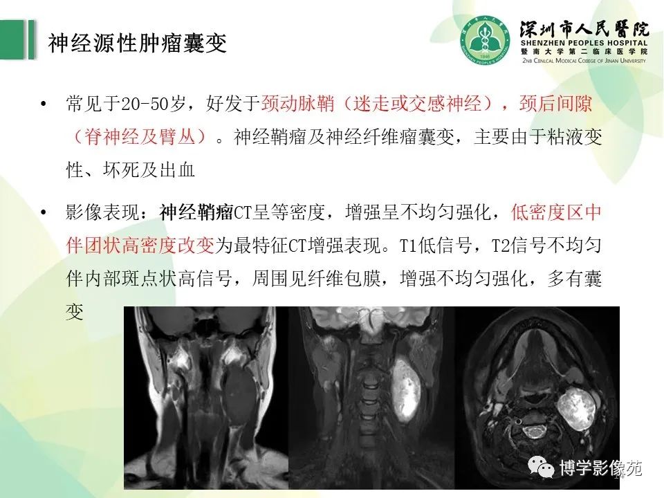 影像PPT - 【PPT】颈部囊性病变-14