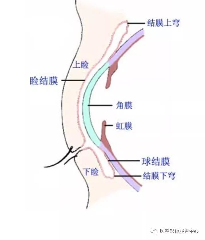 影像PPT - 【病例】眼部这种病变，原来是个“迷”-16