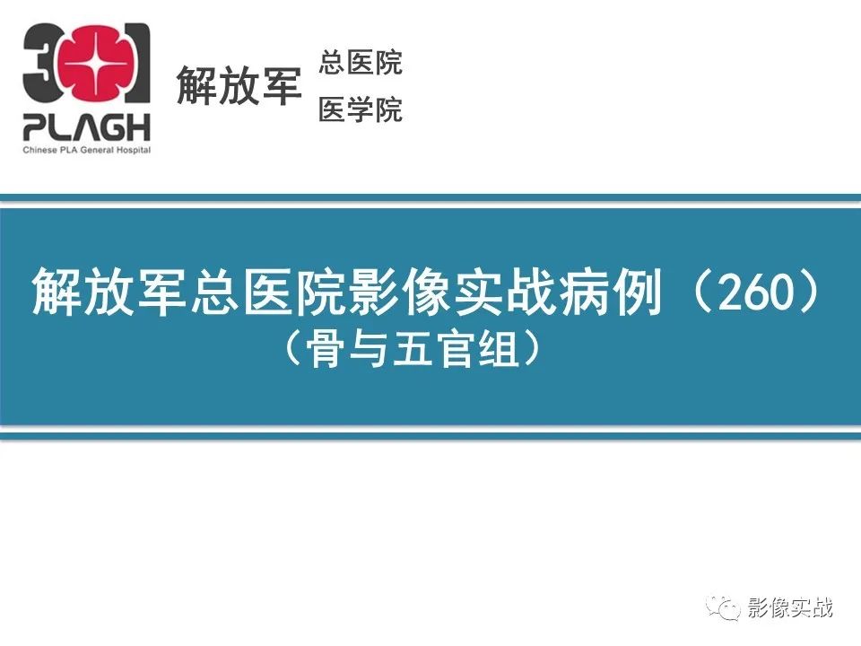 影像PPT - 【病例】骨纤维结构不良1例X线MR影像-1