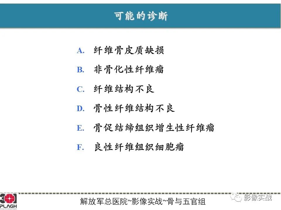 影像PPT - 【病例】骨纤维结构不良1例X线MR影像-9