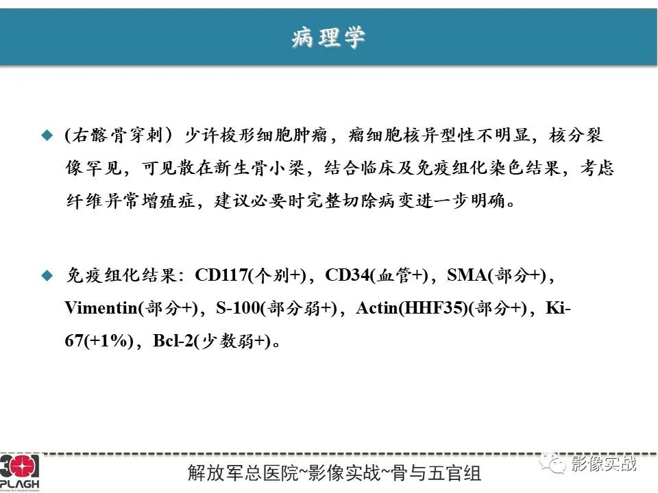 影像PPT - 【病例】骨纤维结构不良1例X线MR影像-10