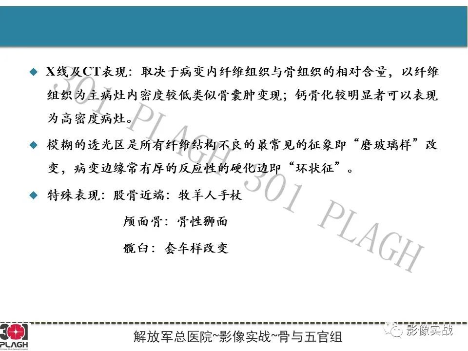影像PPT - 【病例】骨纤维结构不良1例X线MR影像-12