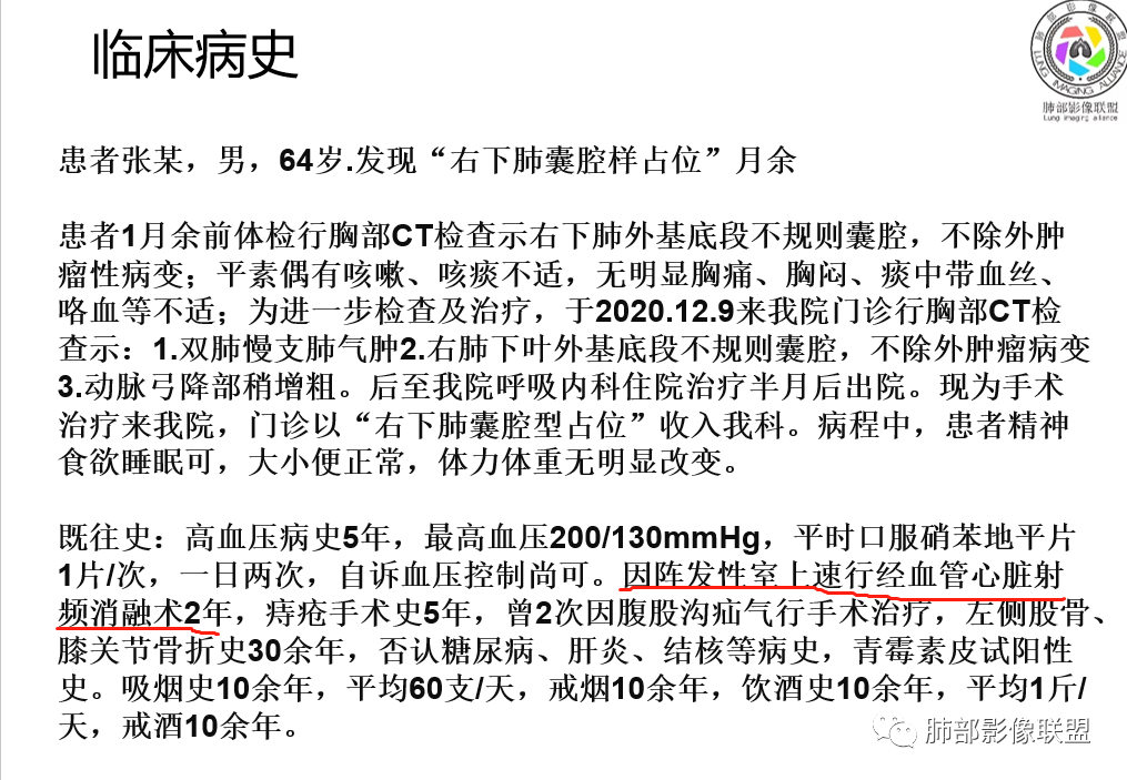 影像PPT - 【病例】一例囊腔性病变诊断思路与鉴别要点-22 影像PPT - 【病例】一例囊腔性病变诊断思路与鉴别要点-22