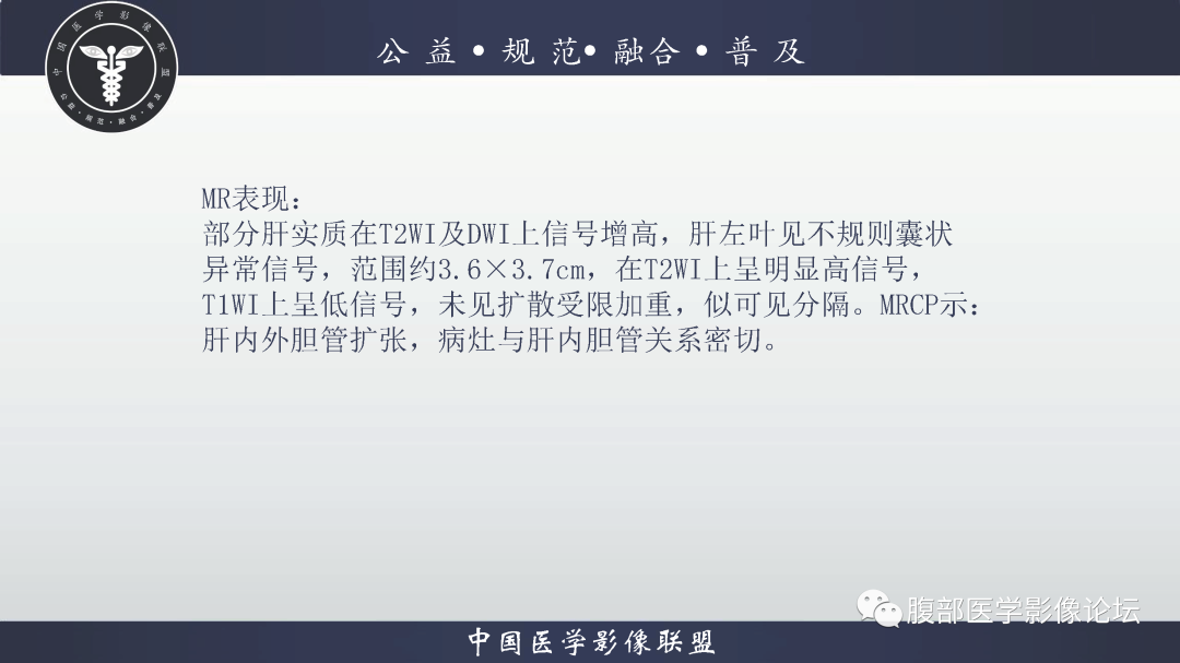 影像PPT - 【病例】肝脏胆管内乳头状肿瘤1例CT及MR-7
