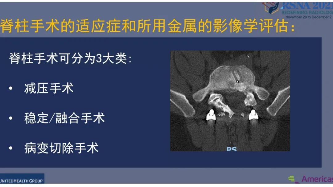 影像PPT - 【PPT】术后脊柱-为了外科医生和患者安全着想的金属图像-5