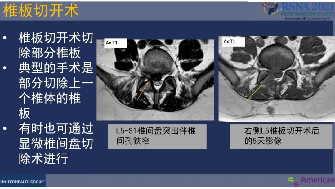 影像PPT - 【PPT】术后脊柱-为了外科医生和患者安全着想的金属图像-9