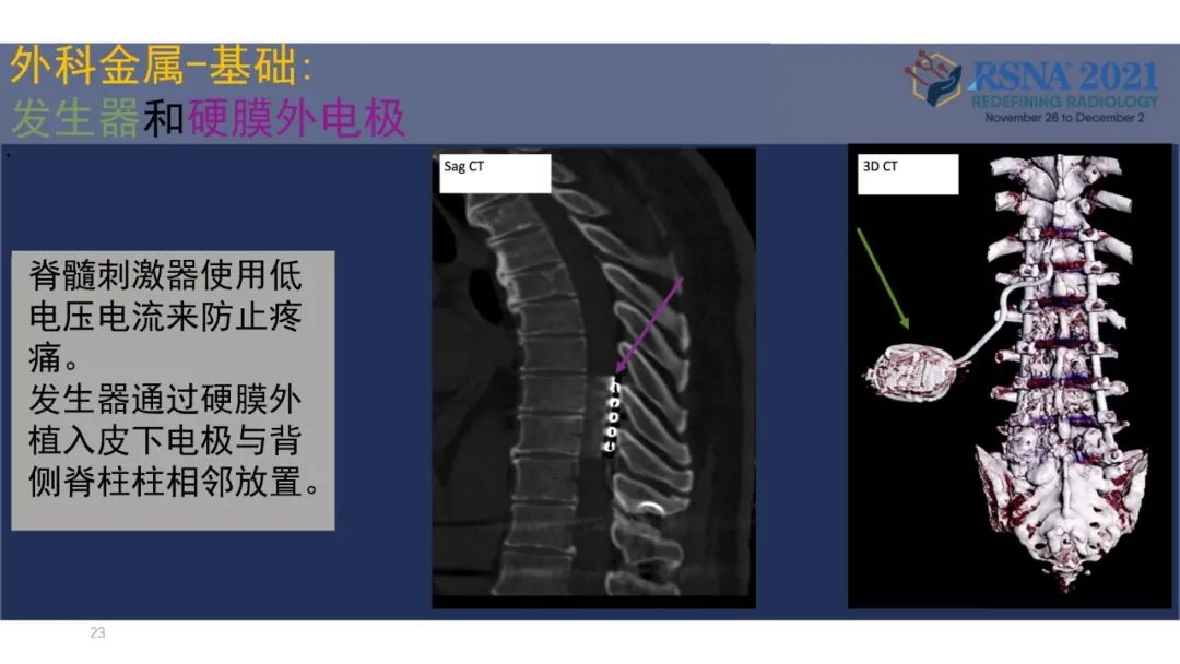 影像PPT - 【PPT】术后脊柱-为了外科医生和患者安全着想的金属图像-23