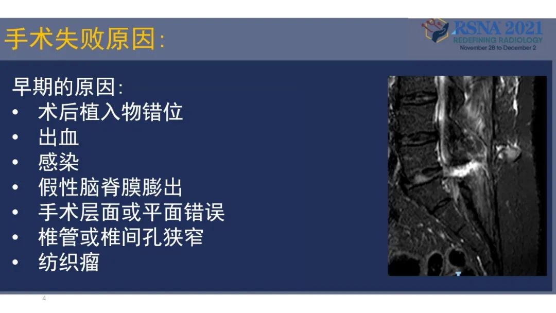 影像PPT - 【PPT】术后脊柱-为了外科医生和患者安全着想的金属图像-27