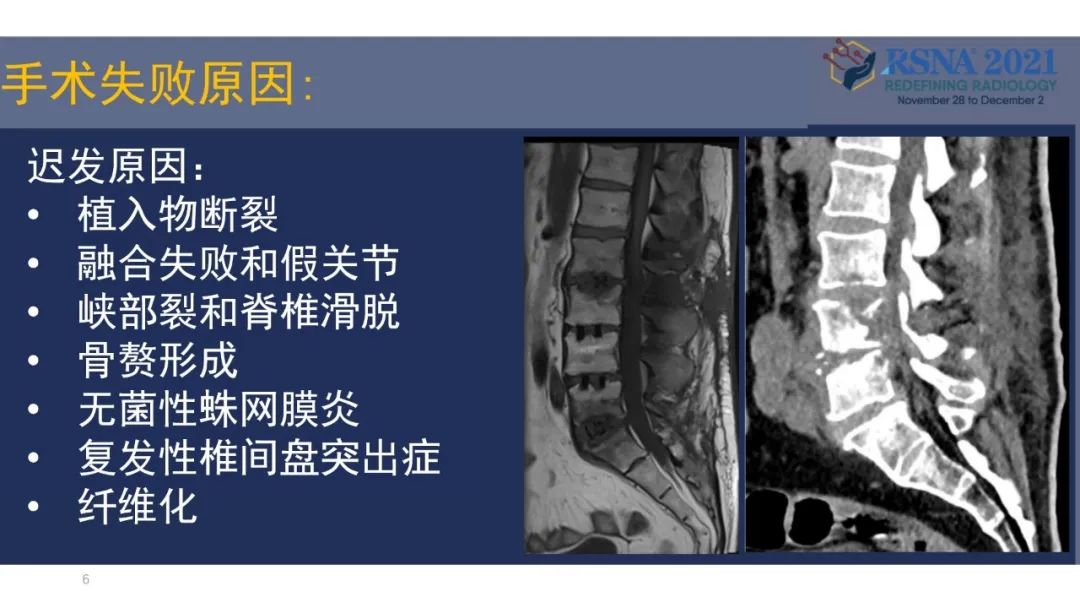 影像PPT - 【PPT】术后脊柱-为了外科医生和患者安全着想的金属图像-29