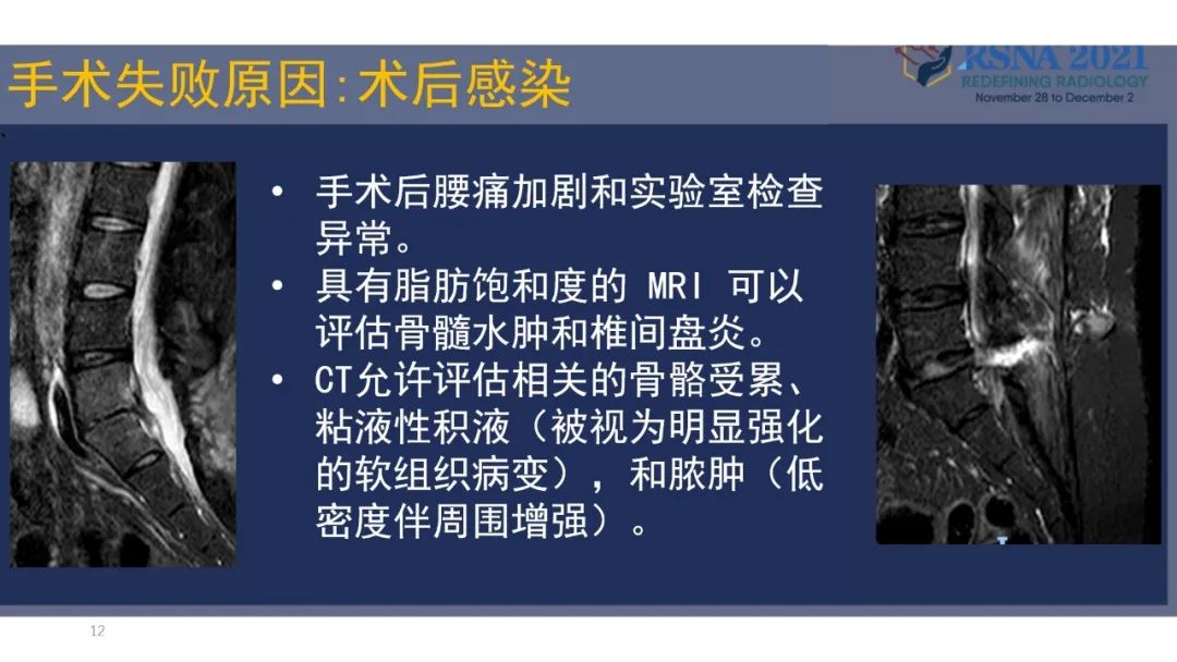 影像PPT - 【PPT】术后脊柱-为了外科医生和患者安全着想的金属图像-35