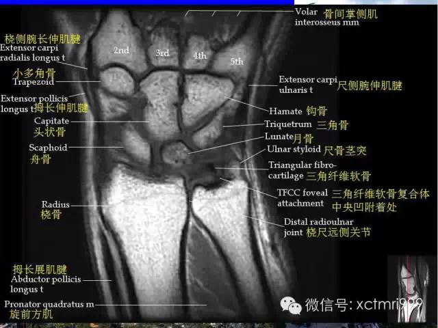 影像PPT - 【PPT】腕关节MRI解剖中英对照-10