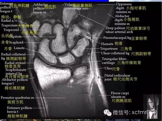 影像PPT - 【PPT】腕关节MRI解剖中英对照-9