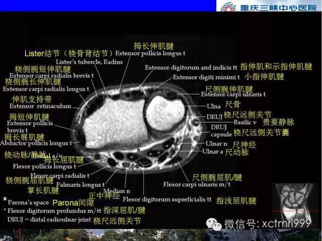 影像PPT - 【PPT】腕关节MRI解剖中英对照-34