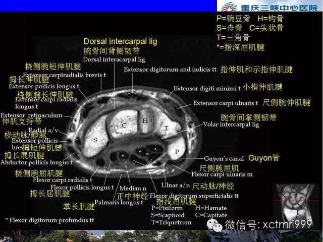 影像PPT - 【PPT】腕关节MRI解剖中英对照-41