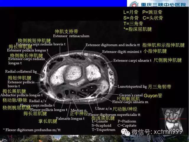 影像PPT - 【PPT】腕关节MRI解剖中英对照-40
