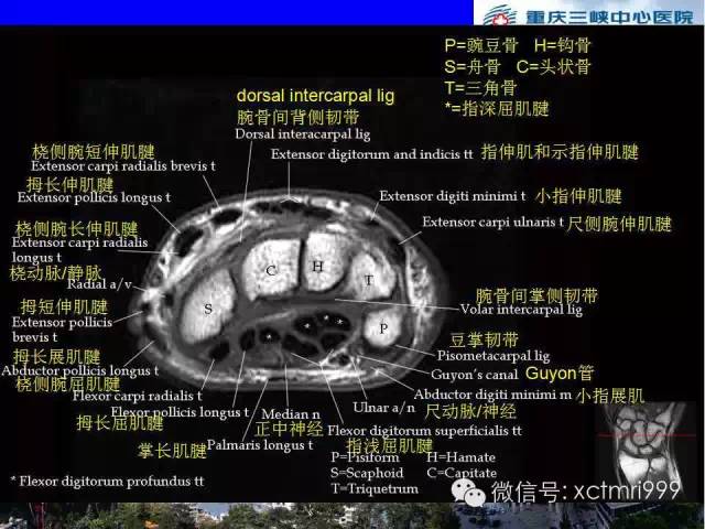 影像PPT - 【PPT】腕关节MRI解剖中英对照-42