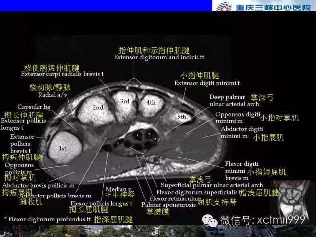 影像PPT - 【PPT】腕关节MRI解剖中英对照-48