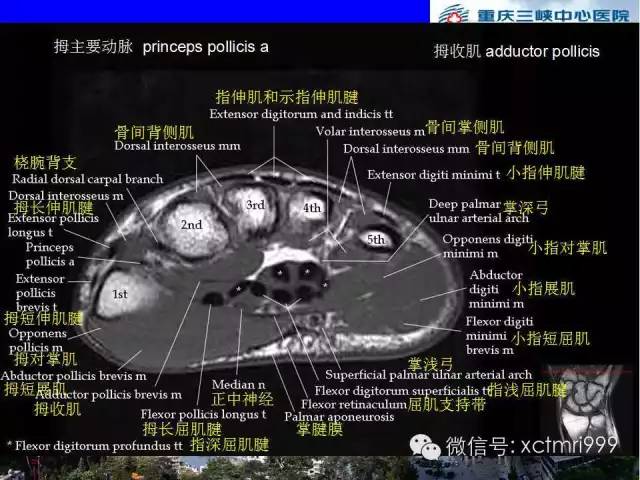 影像PPT - 【PPT】腕关节MRI解剖中英对照-49