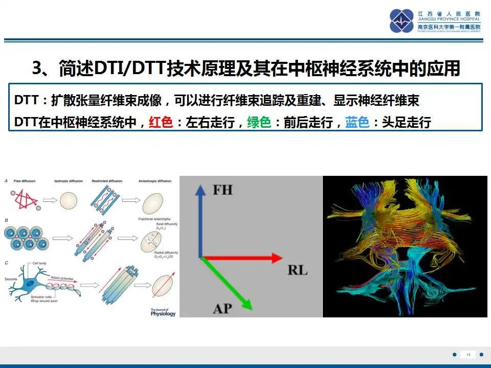 影像PPT - 【PPT】华勒氏变性-14
