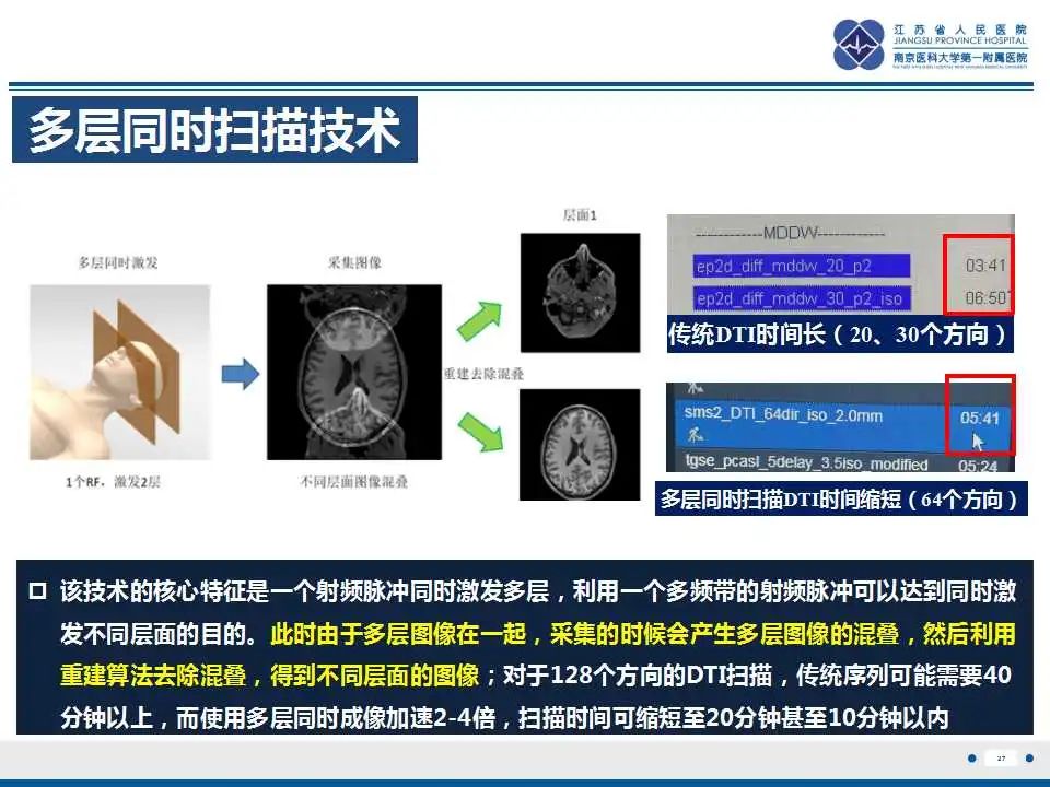 影像PPT - 【PPT】华勒氏变性-28