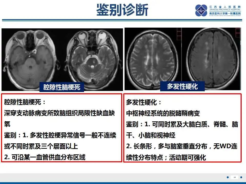影像PPT - 【PPT】华勒氏变性-36