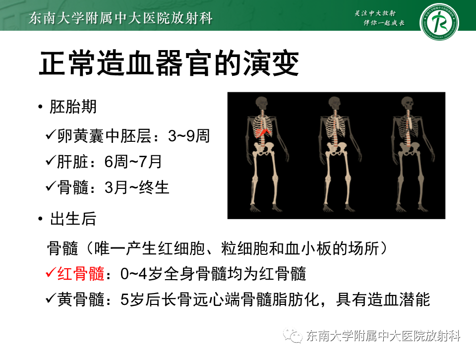 影像PPT - 【PPT】胸内髓外造血的影像表现-5 影像PPT - 【PPT】胸内髓外造血的影像表现-5