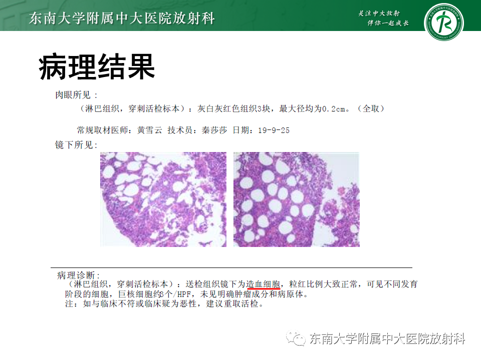 影像PPT - 【PPT】胸内髓外造血的影像表现-18 影像PPT - 【PPT】胸内髓外造血的影像表现-18