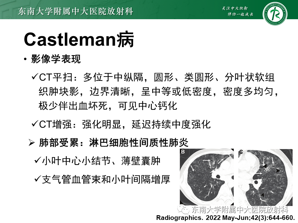 影像PPT - 【PPT】胸内髓外造血的影像表现-26 影像PPT - 【PPT】胸内髓外造血的影像表现-26