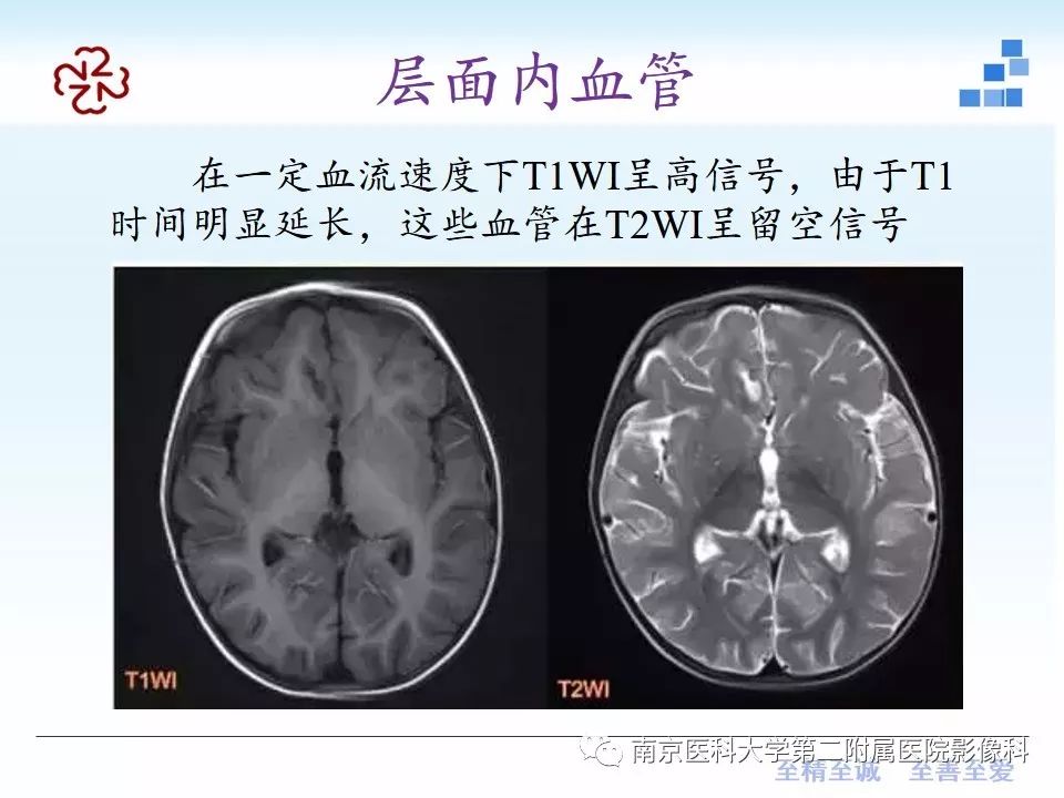 影像PPT - 【PPT】颅内短T1信号的影像诊断-7