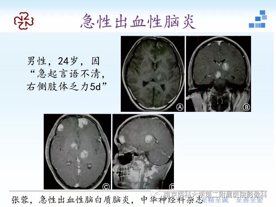 影像PPT - 【PPT】颅内短T1信号的影像诊断-15