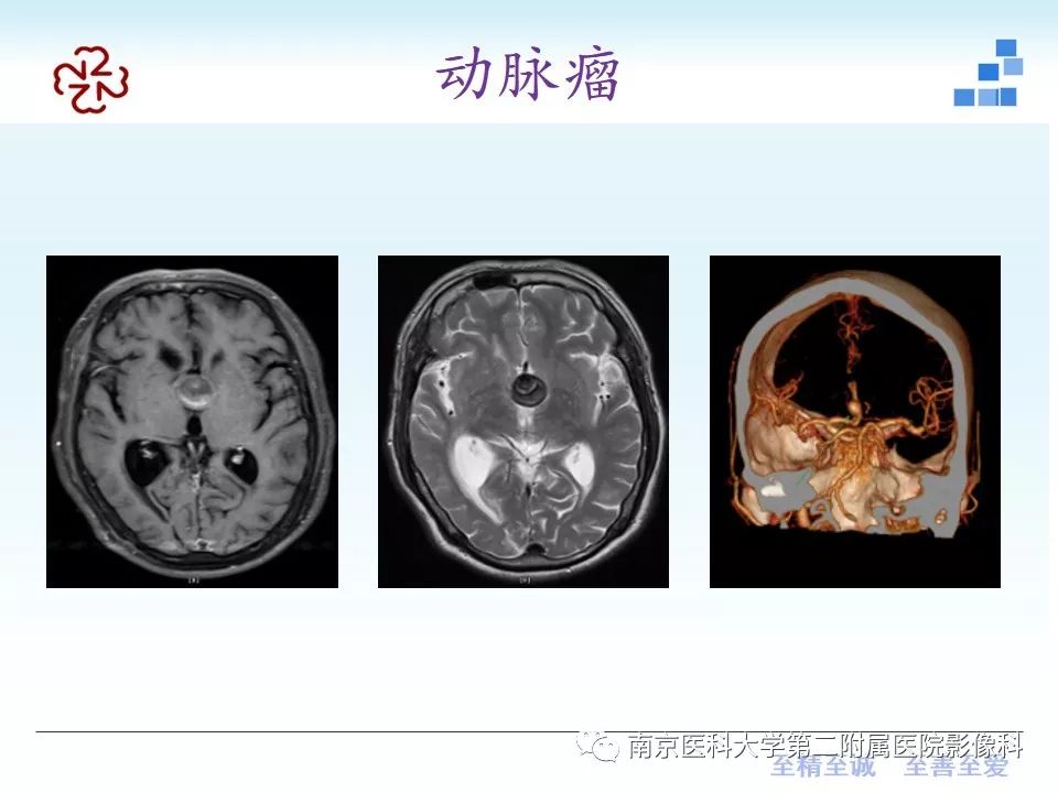 影像PPT - 【PPT】颅内短T1信号的影像诊断-22