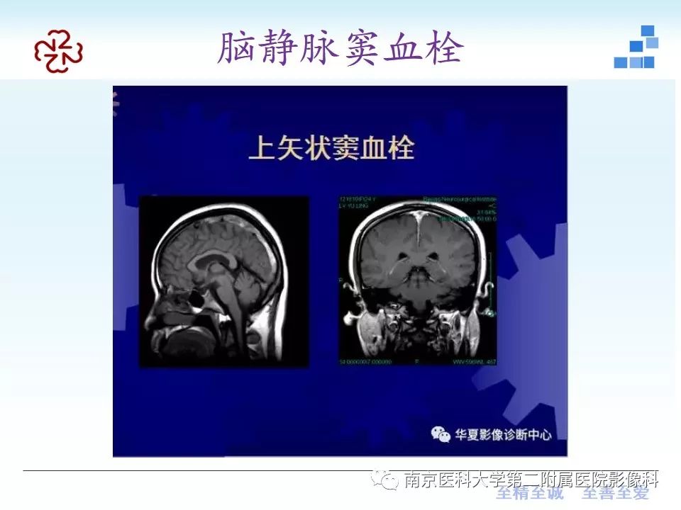 影像PPT - 【PPT】颅内短T1信号的影像诊断-21