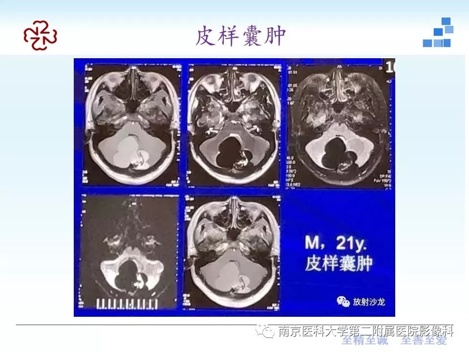 影像PPT - 【PPT】颅内短T1信号的影像诊断-27