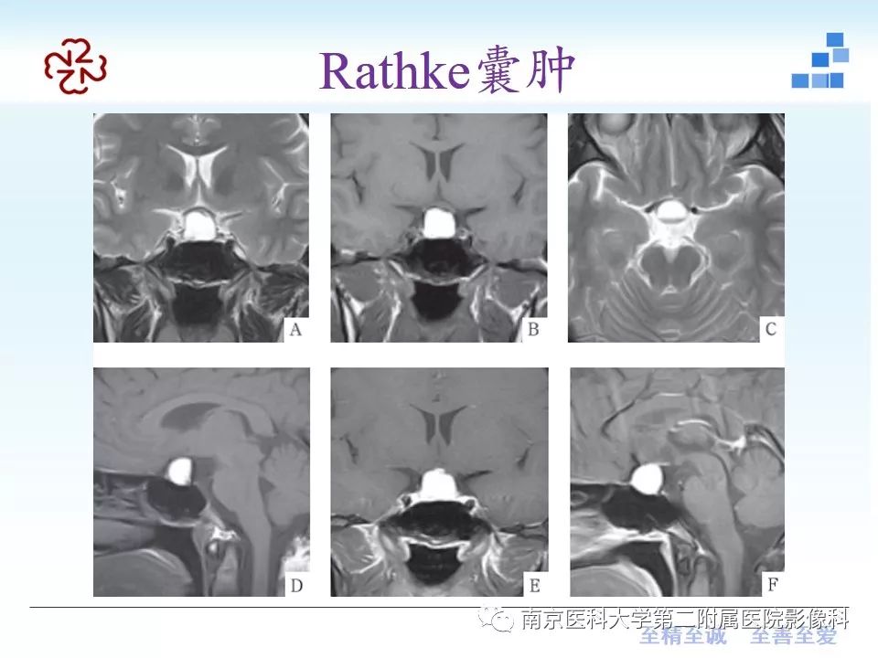 影像PPT - 【PPT】颅内短T1信号的影像诊断-30