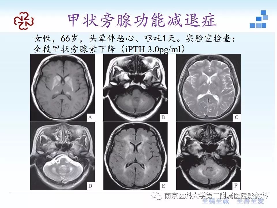 影像PPT - 【PPT】颅内短T1信号的影像诊断-37