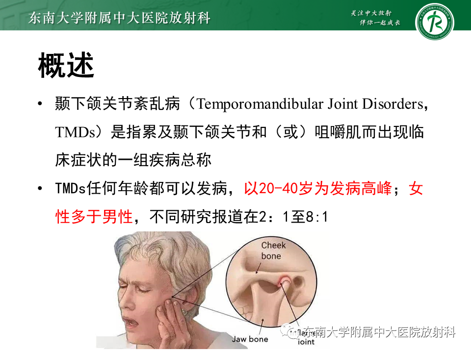 影像PPT - 【PPT】颞下颌关节紊乱病MR表现-5