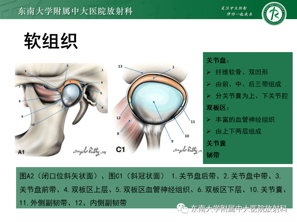 影像PPT - 【PPT】颞下颌关节紊乱病MR表现-10