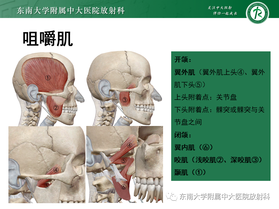影像PPT - 【PPT】颞下颌关节紊乱病MR表现-11