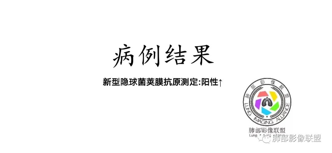 影像PPT - 【病例】从生物特性分析影像识隐球-39 影像PPT - 【病例】从生物特性分析影像识隐球-39